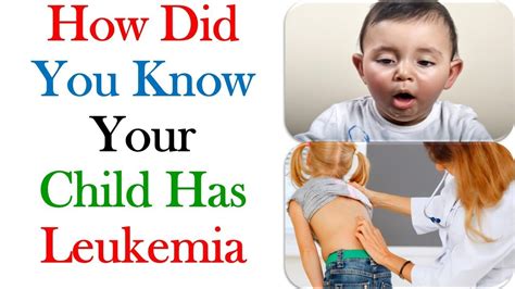 But symptoms of <b>leukemia</b> in <b>children</b> are typically obvious, including persistent fever, sleeping more than normal or limping without injury. . Worried my child has leukemia reddit